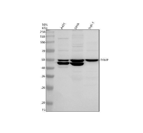 Western blot analysis of PD-ECGF/TYMP using anti-PD-ECGF/TYMP antibody (A06329-1)