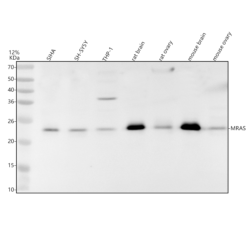 a06332 2 mras primary antibodies wb testing 1