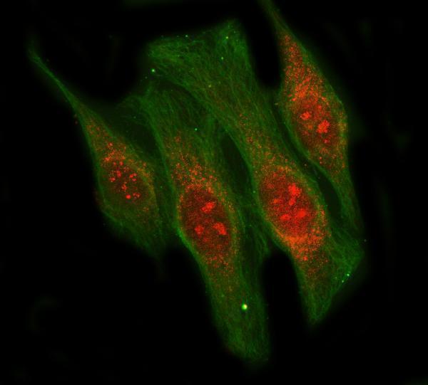  IF analysis of LIN9 using anti-LIN9 antibody (A06333-1) and anti-Beta Tubulin antibody (M01857-3)