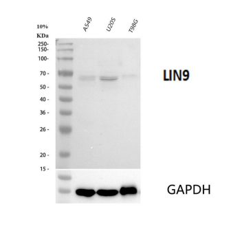  Western blot analysis of LIN9 using anti-LIN9 antibody (A06333-1)