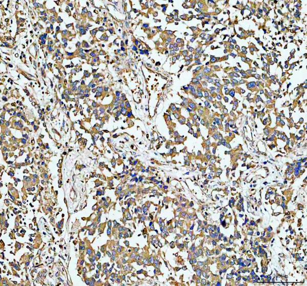 a06336 1 inpp4b primary antibodies ihc testing 1