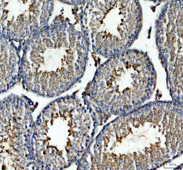 a06336 1 inpp4b primary antibodies ihc testing 2