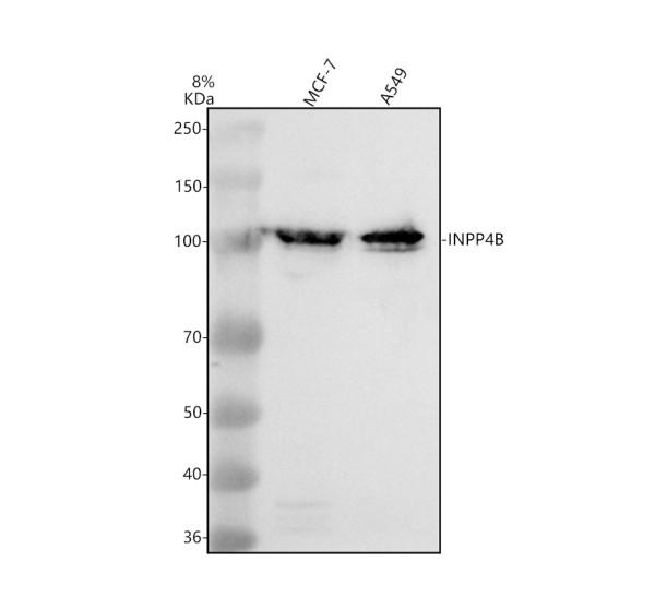 a06336 1 inpp4b primary antibodies wb testing 1
