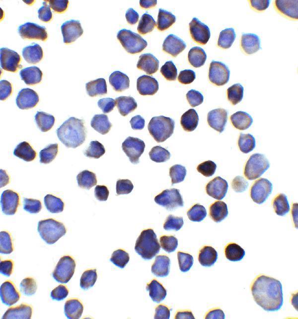 Immunocytochemistry of INPP4B in 3T3 cells with INPP4B antibody at 2