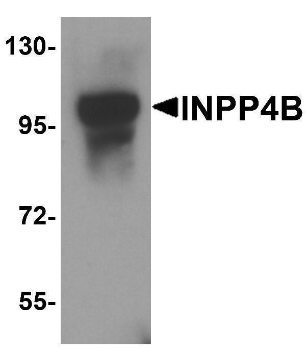 Western blot analysis of INPP4B in 3T3 cell lysate with INPP4B antibody at 1 μg/ml