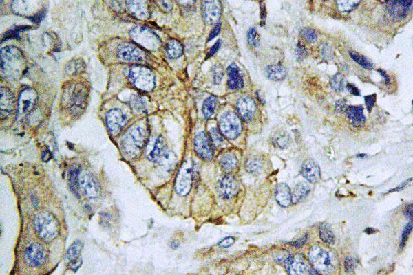 a06337 npy5r primary antiboties ihc testing 2