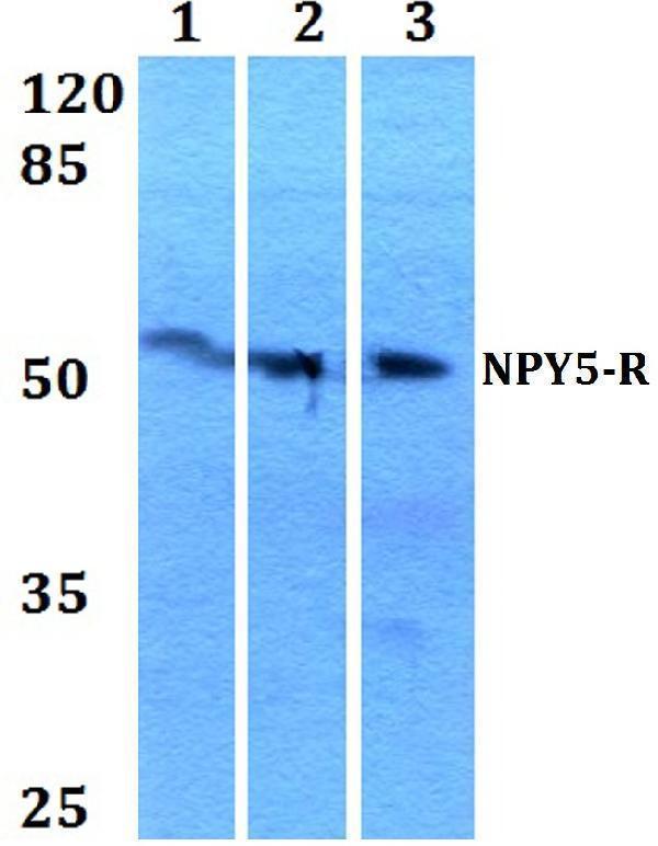 a06337 npy5r primary antiboties wb testing 1