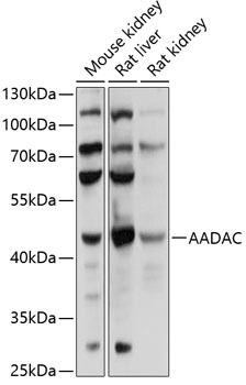 Western blot analysis of extracts of various cell lines, using AADAC antibody  at 1:1000 dilution