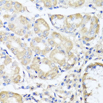 Immunohistochemistry of paraffin-embedded human gastric using OPA3 antibody at dilution of 1:100 (x40 lens)