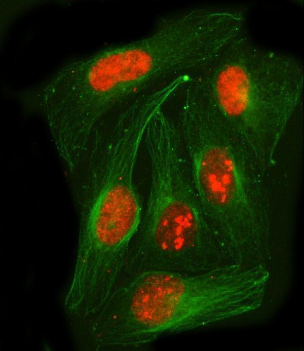 a06348 1 pspc1 primary antibodies if testing 4