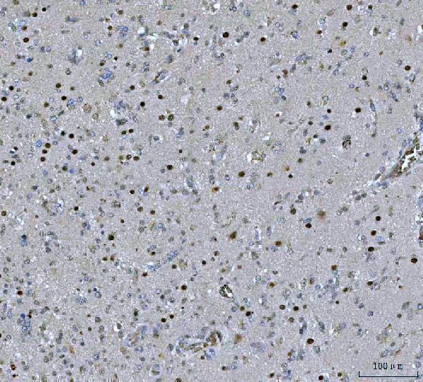  IHC analysis of PSPC1 using anti-PSPC1 antibody (A16132-1)