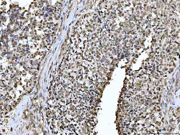  IHC analysis of PSPC1 using anti-PSPC1 antibody (A16132-1)