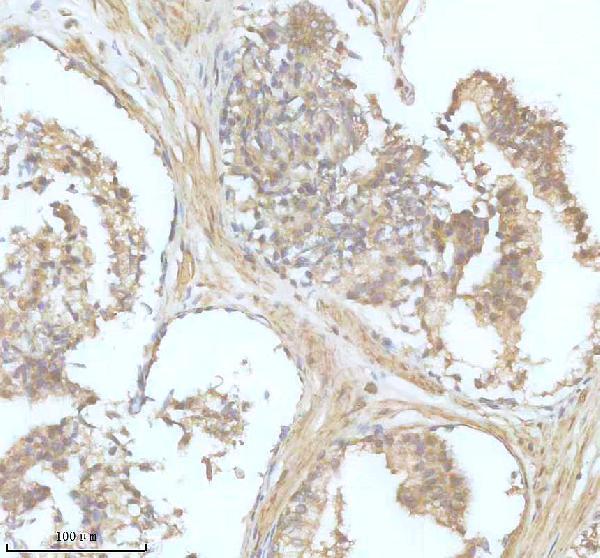 IHC analysis of DOCK6 using anti-DOCK6 antibody (A06349)