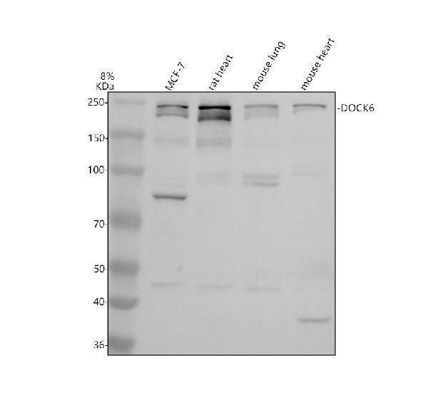 Western blot analysis of DOCK6 using anti-DOCK6 antibody (A06349)