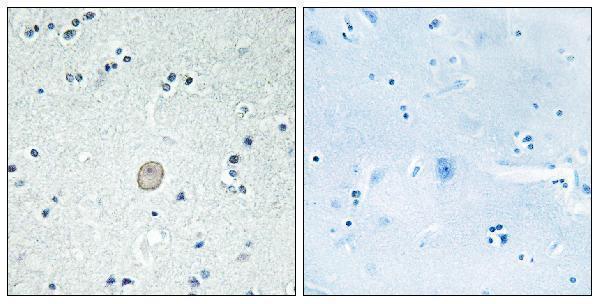 Immunohistochemistry analysis of paraffin-embedded human brain tissue, using C3AR1 Antibody