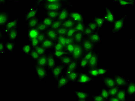 Immunofluorescence analysis of A-549 cells using COPS2 antibody 