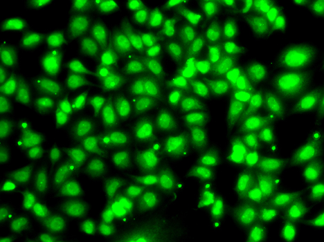 Immunohistochemistry of paraffin-embedded rat kidney using COPS2 antibody  at dilution of 1:100 