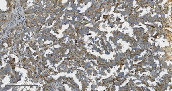  IHC analysis of K Cadherin/CDH6 using anti-K Cadherin/CDH6 antibody (A06353-1)