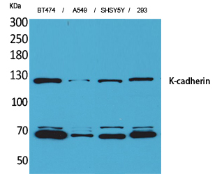 Western Blot analysis of BT474, A549, SHSY5Y, 293 cells using K-cadherin Polyclonal Antibody