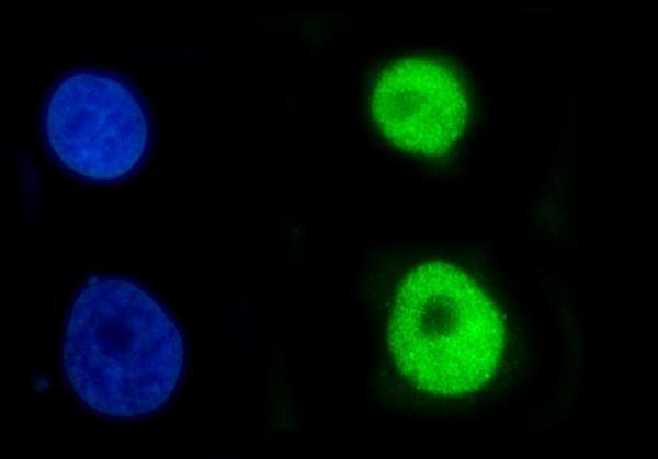 a06356 2 cbx2 primary antibodies if testing 6