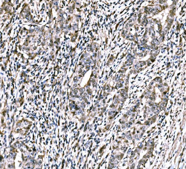 a06356 2 cbx2 primary antibodies ihc testing 2