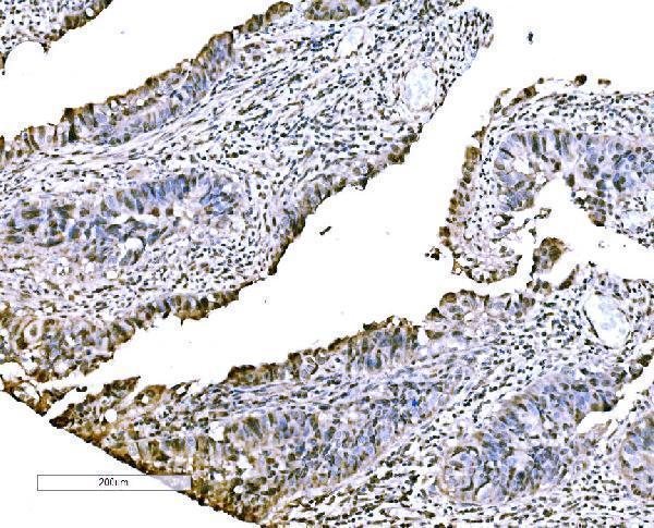 a06356 2 cbx2 primary antibodies ihc testing 3