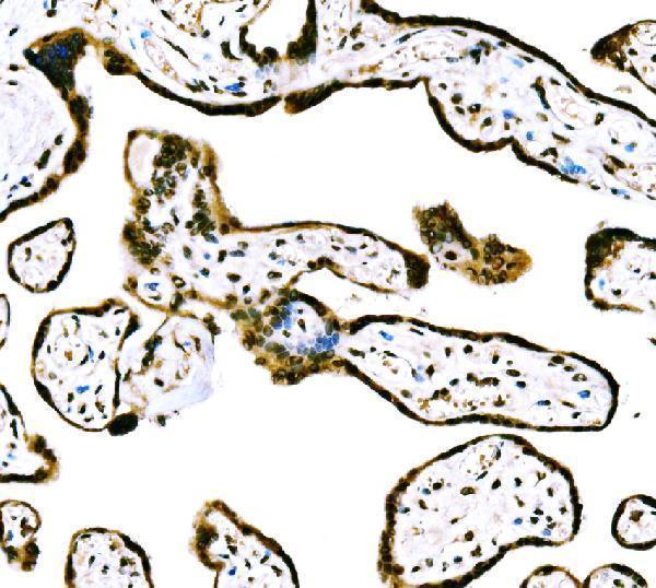a06356 2 cbx2 primary antibodies ihc testing 4