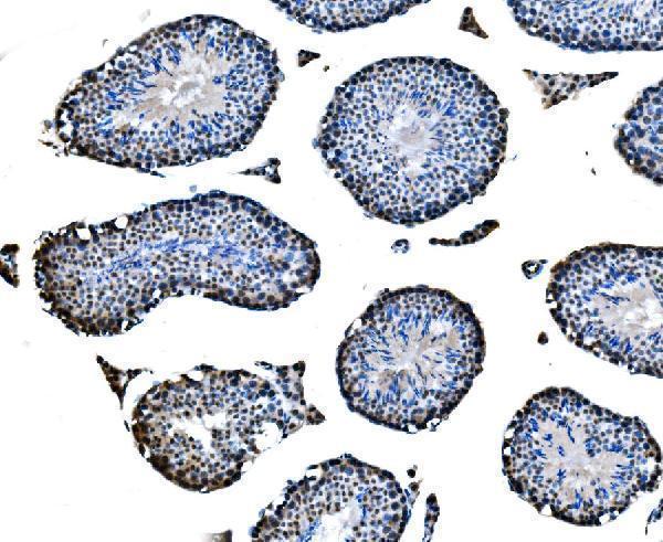 a06356 2 cbx2 primary antibodies ihc testing 5