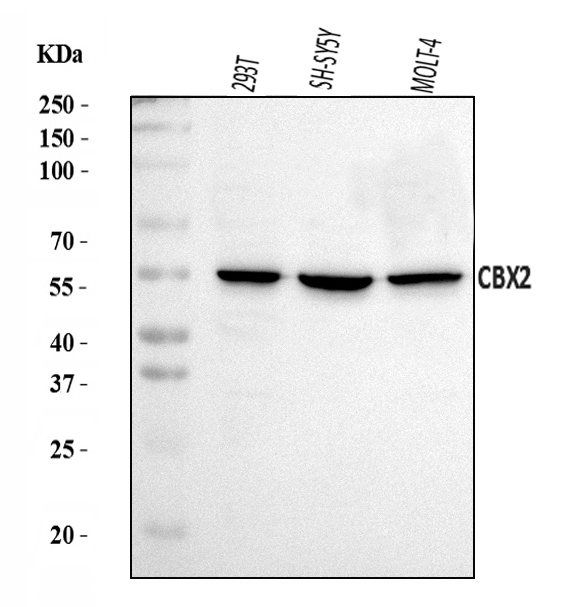 a06356 2 cbx2 primary antibodies wb testing 1