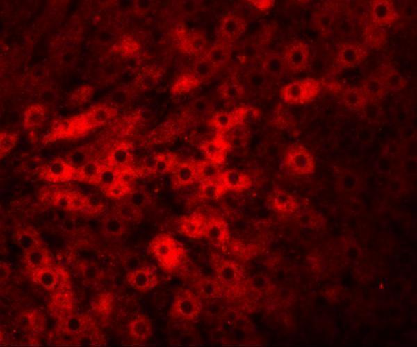 a06360 tmem70 primary antibodies if testing 3