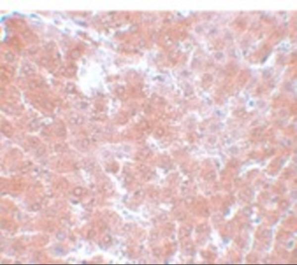 a06360 tmem70 primary antibodies ihc testing 2