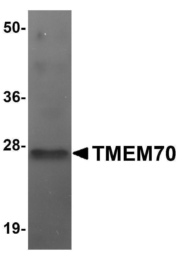 a06360 tmem70 primary antibodies wb testing 1