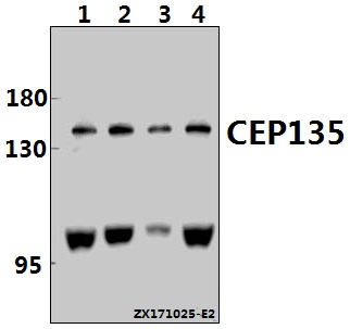 Western blot (WB) analysis of CEP135 (H1117) pAb at 1:1000 dilution
Lane1:PC12 whole cell lysate(40ug)
Lane2:A2780 whole cell lysate(40ug)
Lane3:SK-OVCAR3 whole cell lysate(40ug)
Lane4:Hela whole cell lysate(40ug)
