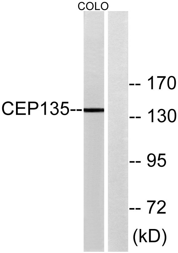 Western blot analysis of lysates from COLO cells, using CEP135 Antibody
