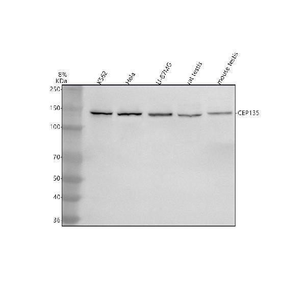  Western blot analysis of CEP135 using anti-CEP135 antibody (A06361-4)