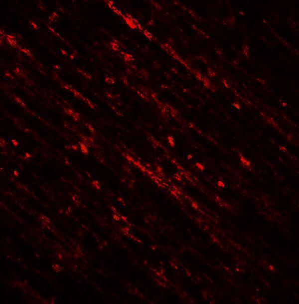 Immunofluorescence of DENR in rat brain tissue with DENR antibody at 20 μg/mL