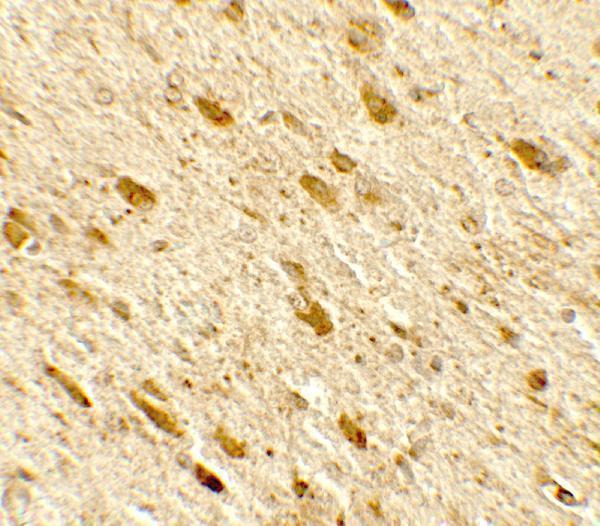 Immunohistochemistry of DENR in rat brain tissue with DENR antibody at 5 μg/mL