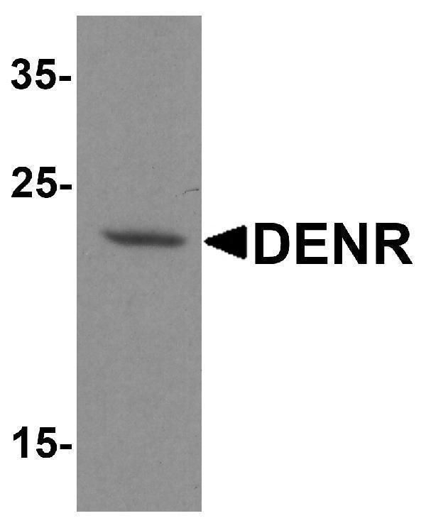 Western blot analysis of DENR in human brain tissue lysate with DENR antibody at 1 μg/ml