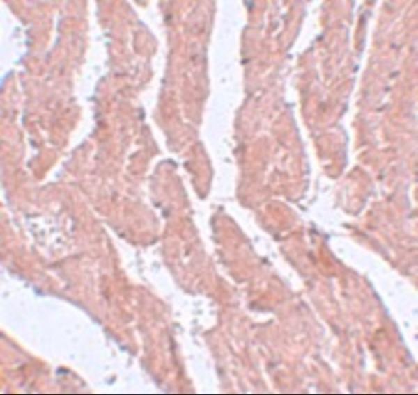 a06363 lztr1 primary antibodies ihc testing 2