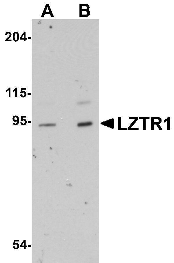 a06363 lztr1 primary antibodies wb testing 1