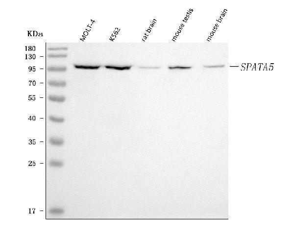  Western blot analysis of SPATA5 using anti-SPATA5 antibody (A06364-1)