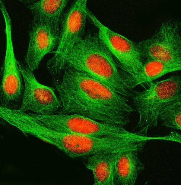  IF analysis of SPRED2 using anti-SPRED2 antibody (A06368-1) and anti-Tubulin Alpha antibody (M03989-3)