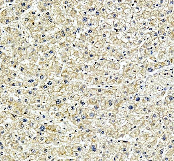 IHC analysis of SPRED2 using anti-SPRED2 antibody (A06368-1)