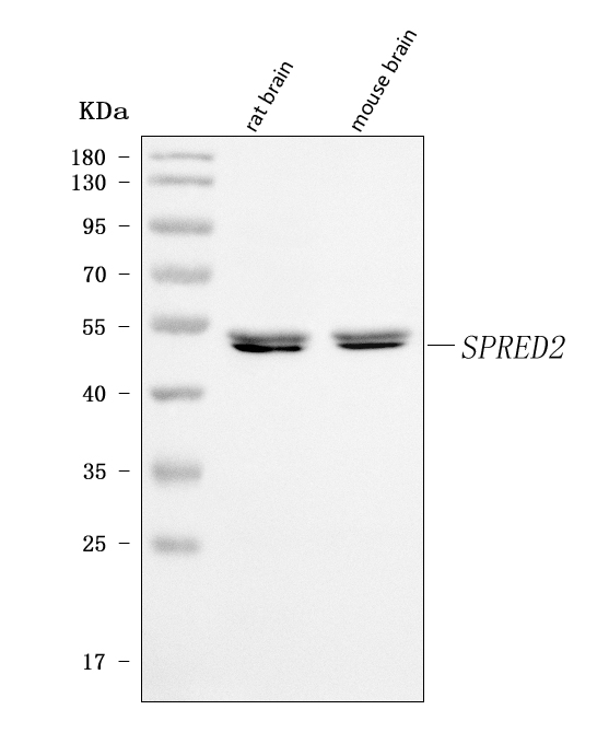  Western blot analysis of SPRED2 using anti-SPRED2 antibody (A06368-1)
