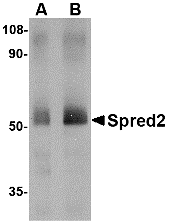 a06368 spred2 primary antibodies wb testing 1