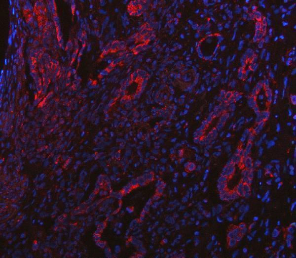 a06369 1 bcat2 primary antibodies if testing 7