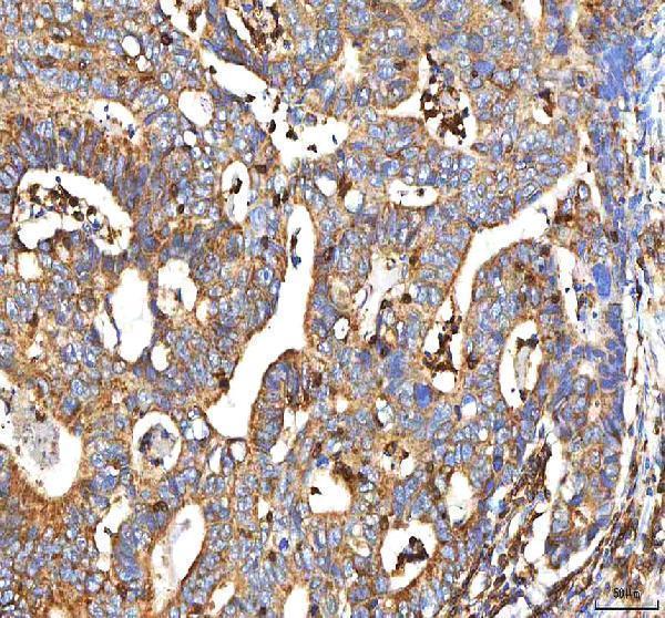  IHC analysis of BCAT2 using anti-BCAT2 antibody (A06369-1)