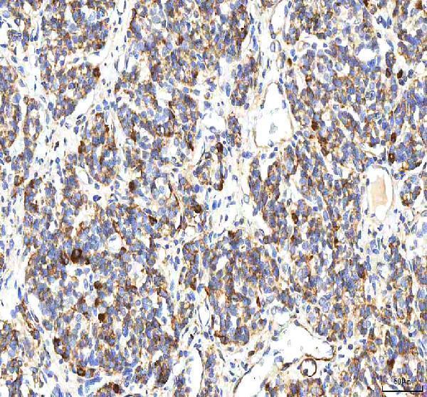 a06369 1 bcat2 primary antibodies ihc testing 4
