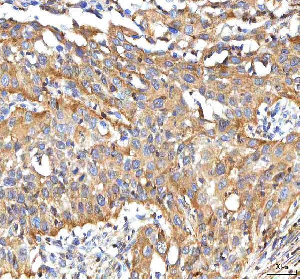 a06369 1 bcat2 primary antibodies ihc testing 5