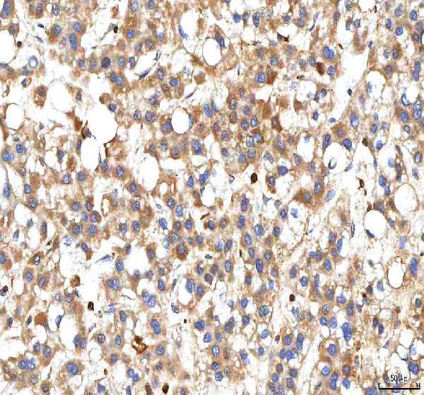 a06369 1 bcat2 primary antibodies ihc testing 6